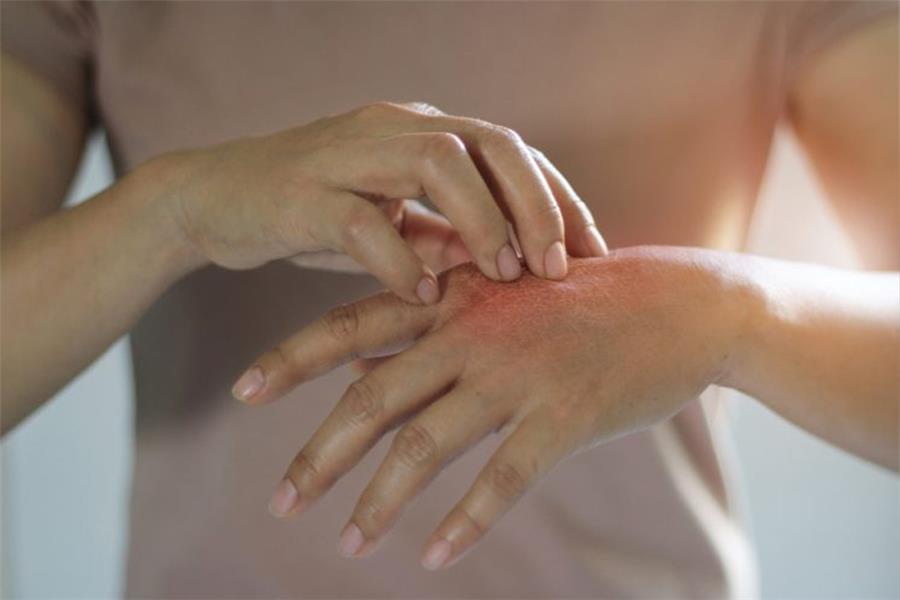 حساسیت به طلا را چگونه درمان کنیم؟